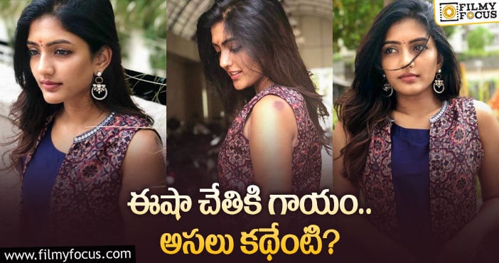 Eesha Rebba: ఈషా రెబ్బా లేటెస్ట్ ఫోటోలలో ఇది గమనించారా?