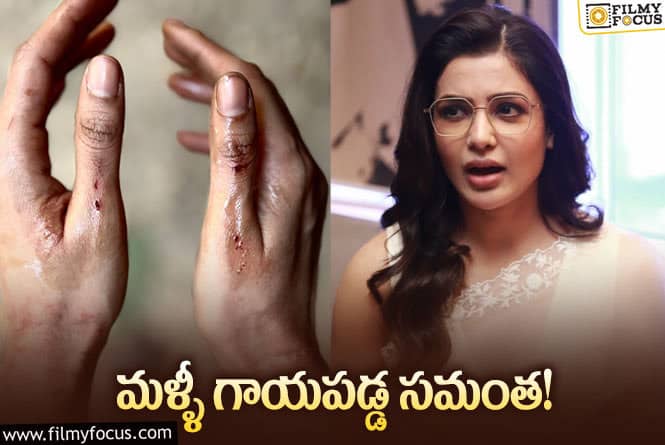 Samantha: షూటింగ్లో గాయపడ్డ సమంత వైరల్ అవుతున్న ఫోటో!