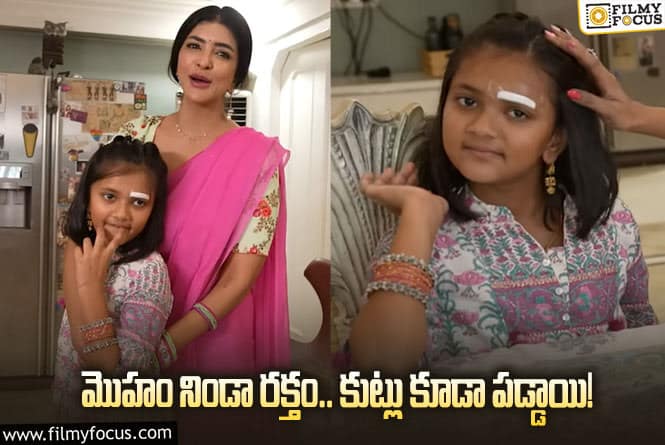 Manchu Lakshmi: మంచు లక్ష్మీ కూతురుకి యాక్సిడెంట్.. తీవ్రంగా గాయాలు!