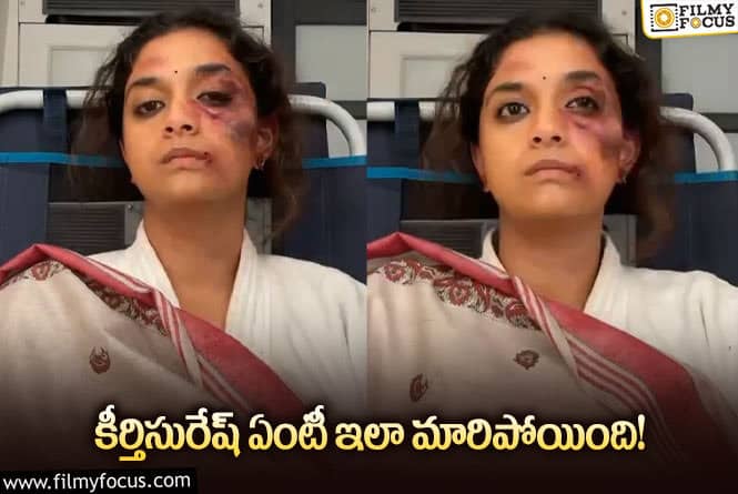 Keerthy Suresh: గాయాల పాలైన కీర్తి సురేష్… గుర్తుపట్టలేనంతగా మారిపోయిన నటి!