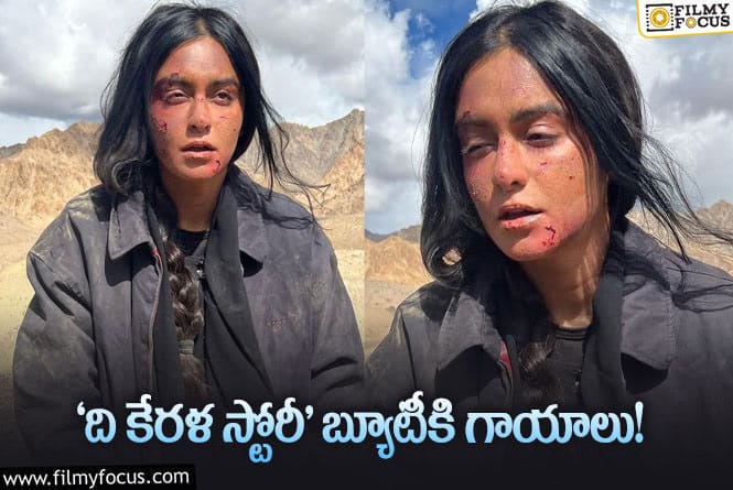 Adah Sharma: ‘ది కేరళ స్టోరీ’ బ్యూటీ అదా శర్మకి ఏమైనట్టు..!