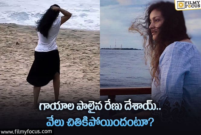 Renu Desai: కాలికి గాయం అయ్యిందంటూ రేణు దేశాయ్ పోస్ట్.. జాగ్రత్తలు చెబుతున్న అభిమానులు!