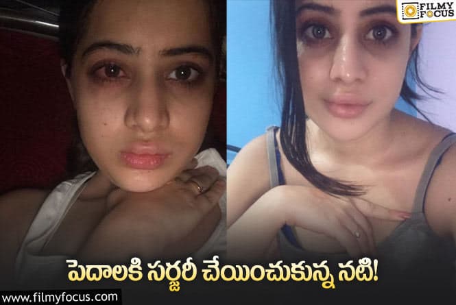 Actress: సర్జరీ చేయించుకుని ఇలా అయిపోయిందట.. నటి షాకింగ్ కామెంట్స్!