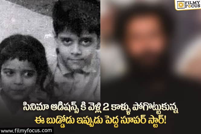 Star Hero: 23 సర్జరీలు చేయించి తన కాళ్ళను తిరిగి రప్పించుకున్న స్టార్ హీరో