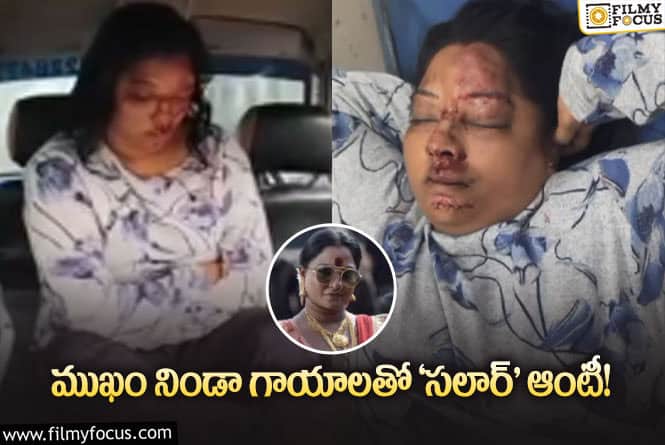 Pooja Vishweswar: సలార్ ఆంటీకి యాక్సిడెంట్.. వైరల్ అవుతున్న వీడియో!